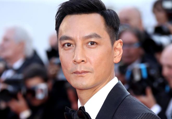 Ngô Ngạn Tổ phải nhập viện khâu 6 mũi vì cứu người-2