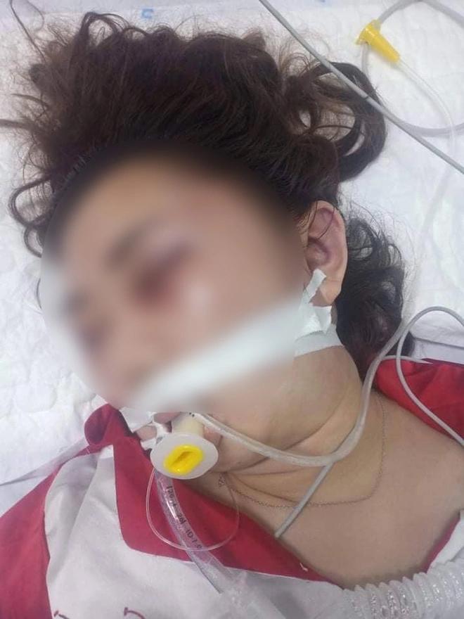 Nữ sinh viên tử vong bất thường, nghi bị bạn trai hành hung-2