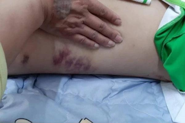 Nam thanh niên lên tiếng khi bị tố cáo đánh bạn gái 22 tuổi-2