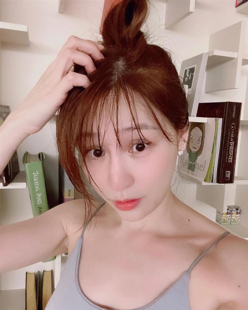 Lý do Vương Tâm Lăng từng bị biến dạng gương mặt-2