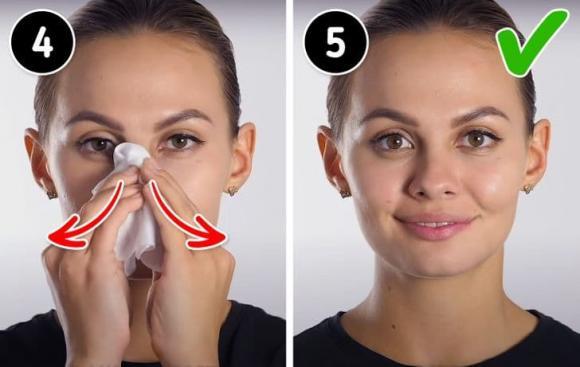 4 cách để loại bỏ mụn đầu đen trên mũi của bạn-3