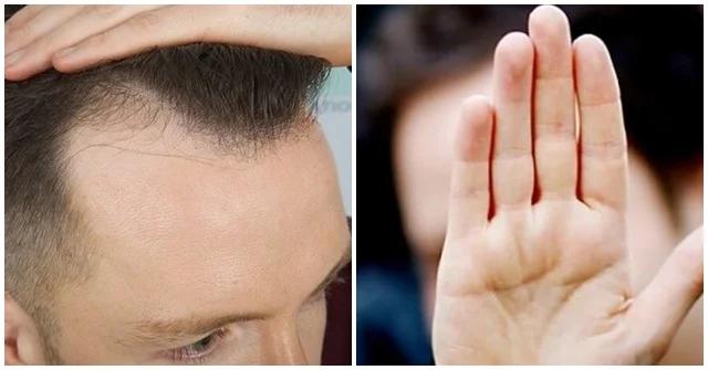 Đàn ông có 3 thứ to, 1 thứ dài thì số mệnh giàu sang phú quý-1