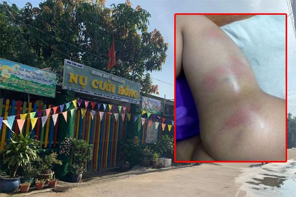 Thanh niên câm điếc nghi bị đánh đến bất tỉnh ở nghĩa trang-2