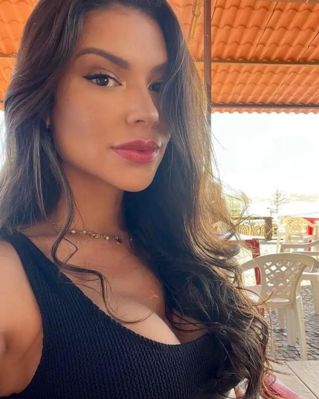 Hoa hậu Brazil qua đời ở tuổi 27 sau khi cắt amidan-1