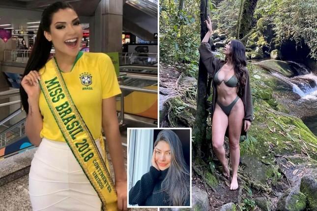 Hoa hậu Brazil qua đời ở tuổi 27 sau khi cắt amidan-3