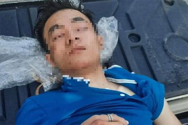 Thanh niên bị chủ quán lẩu nướng đánh đập biến dạng khuôn mặt-2