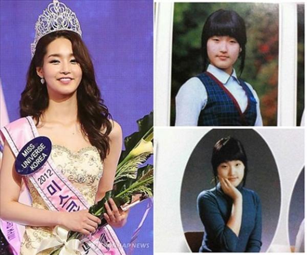 Mỹ nhân phẫu thuật thành bản sao Park Min Young: khiến bản gốc bị oan cả đời-2