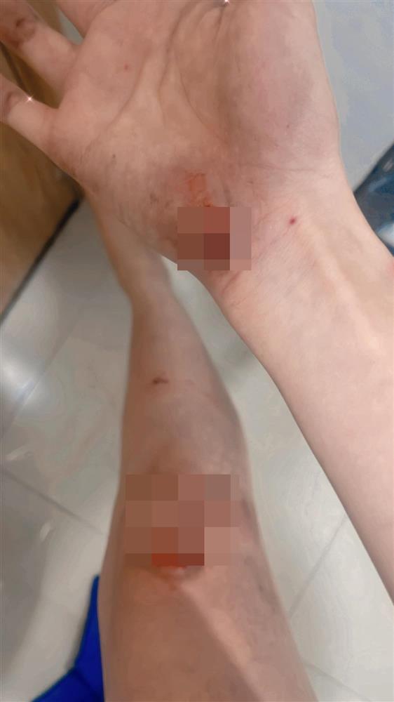 Hoa hậu Diễm Hương gặp chấn thương giữa lùm xùm đời tư-2