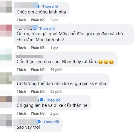 Hoa hậu Diễm Hương gặp chấn thương giữa lùm xùm đời tư-4