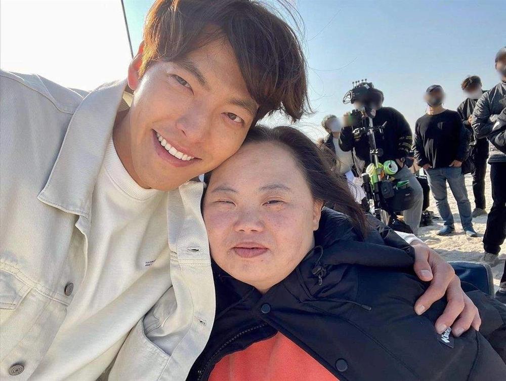 Cuộc đời nữ diễn viên mắc hội chứng Down-2