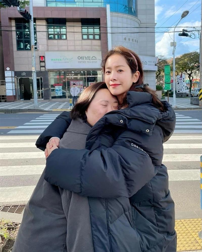 Cuộc đời nữ diễn viên mắc hội chứng Down-3