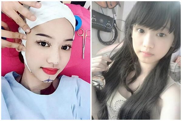 Bạch Lan Phương trao giải 2000$ cho ai chứng minh mình dao kéo-9