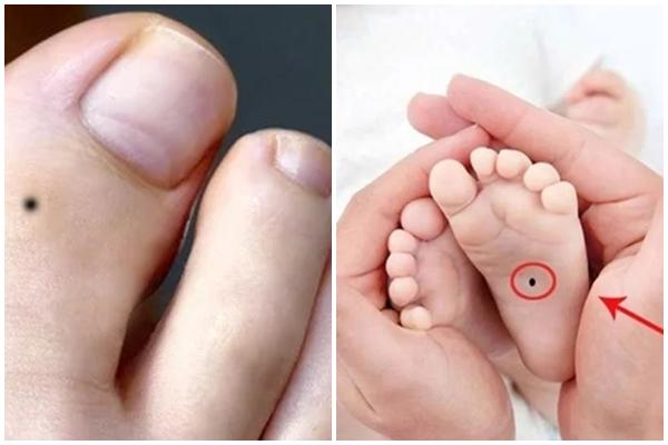 7 nốt ruồi báo trước vận xui, dính dù chỉ 1 cũng bị đen đủi bủa vây-2