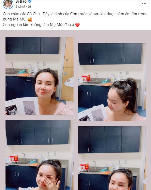 Múi Xù rớt nước mắt show ảnh phôi thai lựa từ giống Mỹ-1