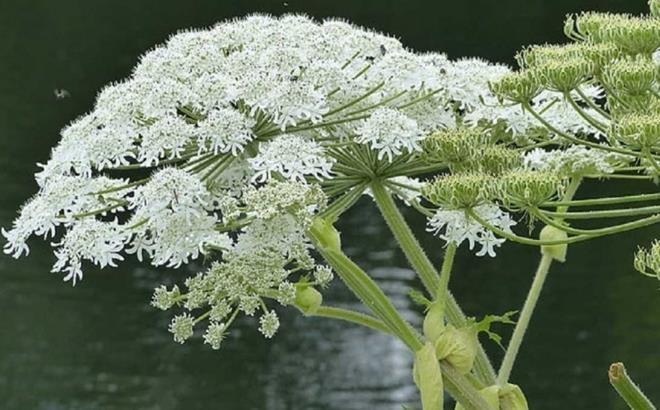 Cây sứ giả địa ngục khiến bé trai bỏng mặt chỉ sau cú chạm nhẹ-2