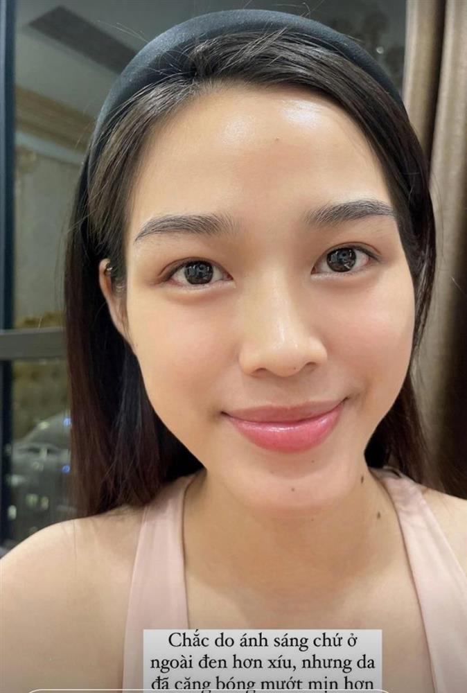 Soi da Hoa hậu: Ngọc Châu có đẹp hoàn hảo bằng Đỗ Thị Hà?-6