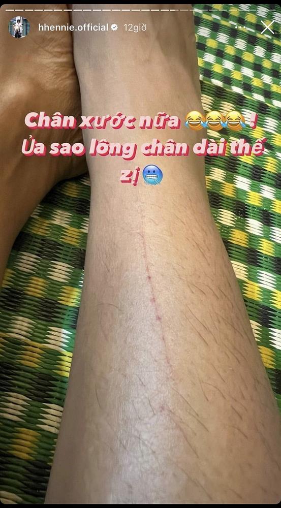 HHen Niê khoe đôi chân đầy lông khiến fan sốc toàn tập-1