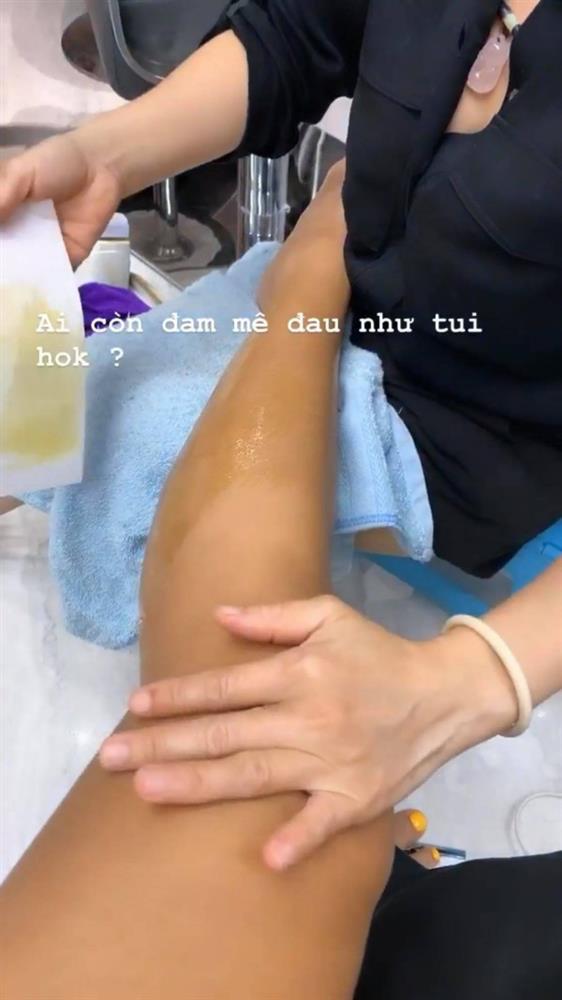 HHen Niê khoe đôi chân đầy lông khiến fan sốc toàn tập-3