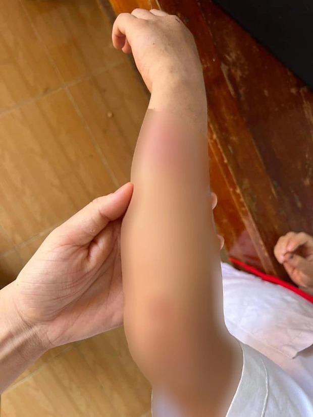 Vụ cháu bé 9 tuổi bị bà và cha đánh đập dã man: Bố mẹ bé nói gì?-4