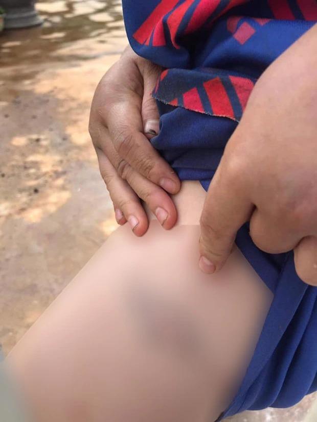 Cháu bé 9 tuổi bị bà và cha đánh đập dã man-6