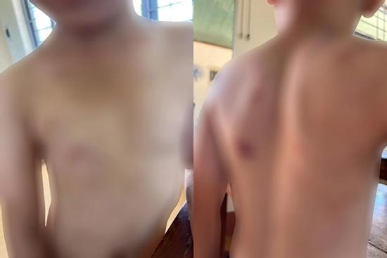 Cháu bé 9 tuổi bị bà và cha đánh đập dã man