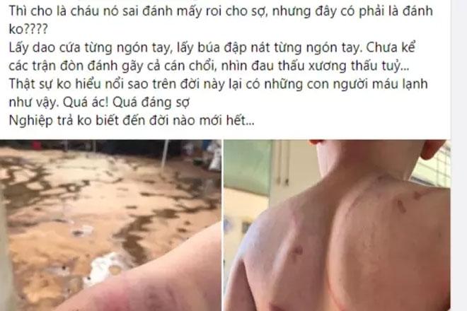 Vụ cháu bé 9 tuổi bị bà và cha đánh đập dã man: Bố mẹ bé nói gì?-1