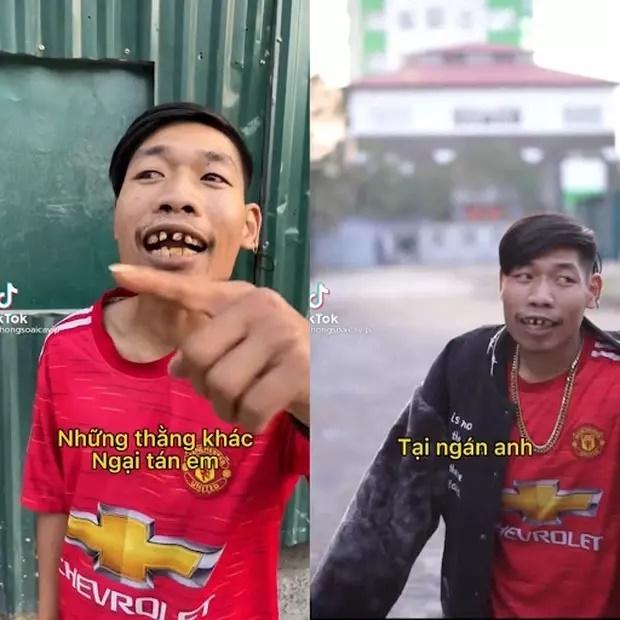 Thông Soái Ca nổi đình đám với bộ răng vâu thương hiệu giờ ra sao?-1