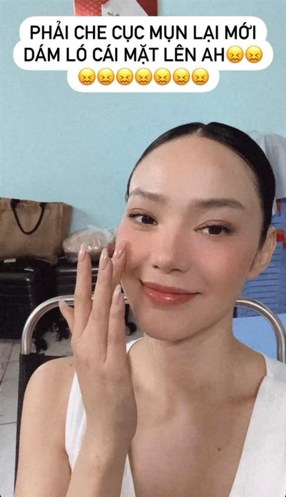 Minh Hằng ốm nhom, mặt mụn sau gần 1 tháng lấy chồng-2