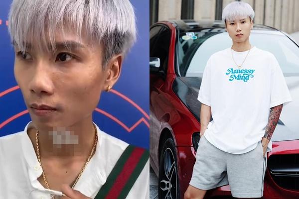 TikToker 7 triệu follower lộ răng ố vàng, da sạm đen nhìn bẩn bẩn-4