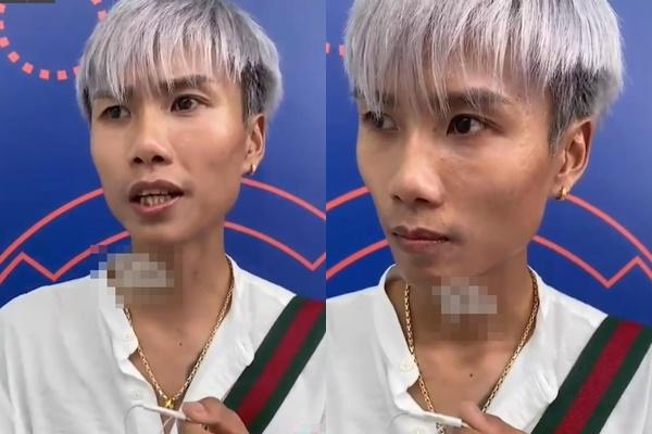 TikToker 3 triệu follower lộ lông nách rậm như rừng Amazon-8