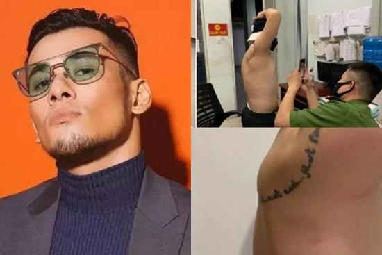 Diễn viên Tùng Min lên tiếng khi bị tố hành hung quản lý