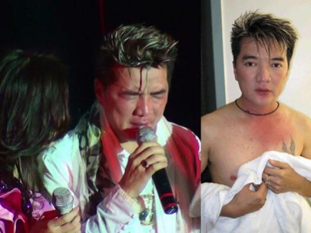 Năm 2010, ca sĩ Đàm Vĩnh Hưng cũng gặp sự cố nghiêm trọng khi lưu diễn tại hải ngoại. Khi song ca cùng Mỹ Tâm, Mr. Đàm bị một người lạ mặt tiến lên sân khấu xịt hơi cay. Ngay lập tức, Mỹ Tâm đã tỏ ra vô cùng tức giận và chạy đến che chắn cho Đàm Vĩnh Hưng. Nữ ca sĩ liên tục hỏi han tình hình của đàn anh, gương mặt không giấu được nỗi hốt hoảng trước sự việc.