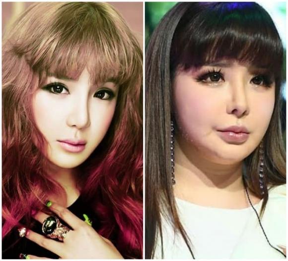 Những khuôn mặt biến dạng vì dao kéo của sao Hàn-4