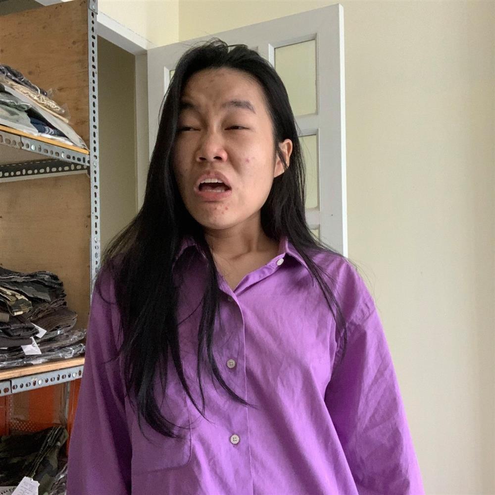 Ngã ngửa ngoại hình TikToker nổi đình đám với cặp nách toàn lông-7