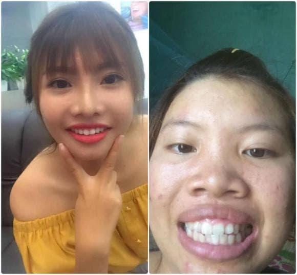 SỐC ngoại hình Thị Nở tái sinh Quách Phượng sau sinh con-4