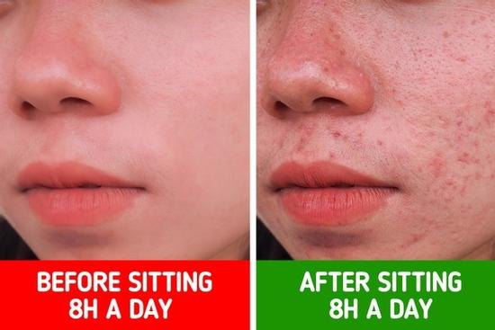 Cơ thể sẽ ra sao nếu ngồi một chỗ quá lâu