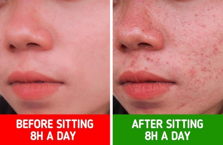 Cơ thể sẽ ra sao nếu ngồi một chỗ quá lâu-1