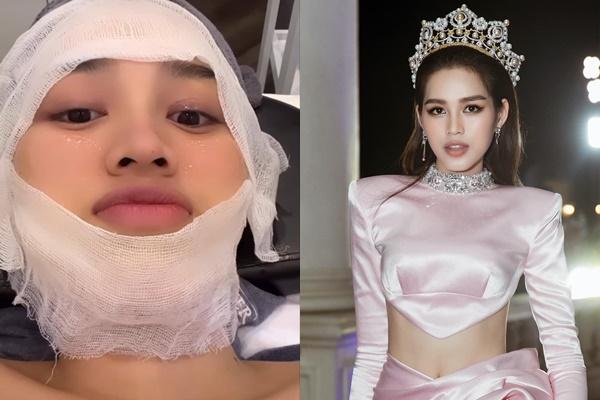 Cao tới 1m78, Lương Thùy Linh vẫn không sánh kịp Đỗ Thị Hà?-10