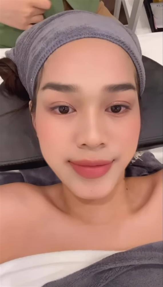 Đỗ Thị Hà băng bó khắp mặt, mới dao kéo hay gì?-3