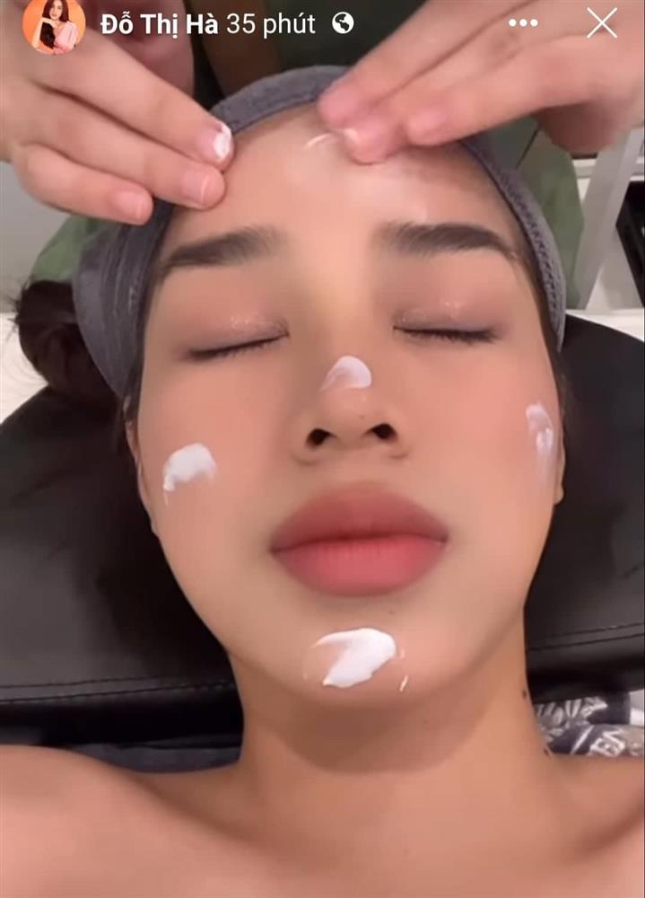 Đỗ Thị Hà băng bó khắp mặt, mới dao kéo hay gì?-4