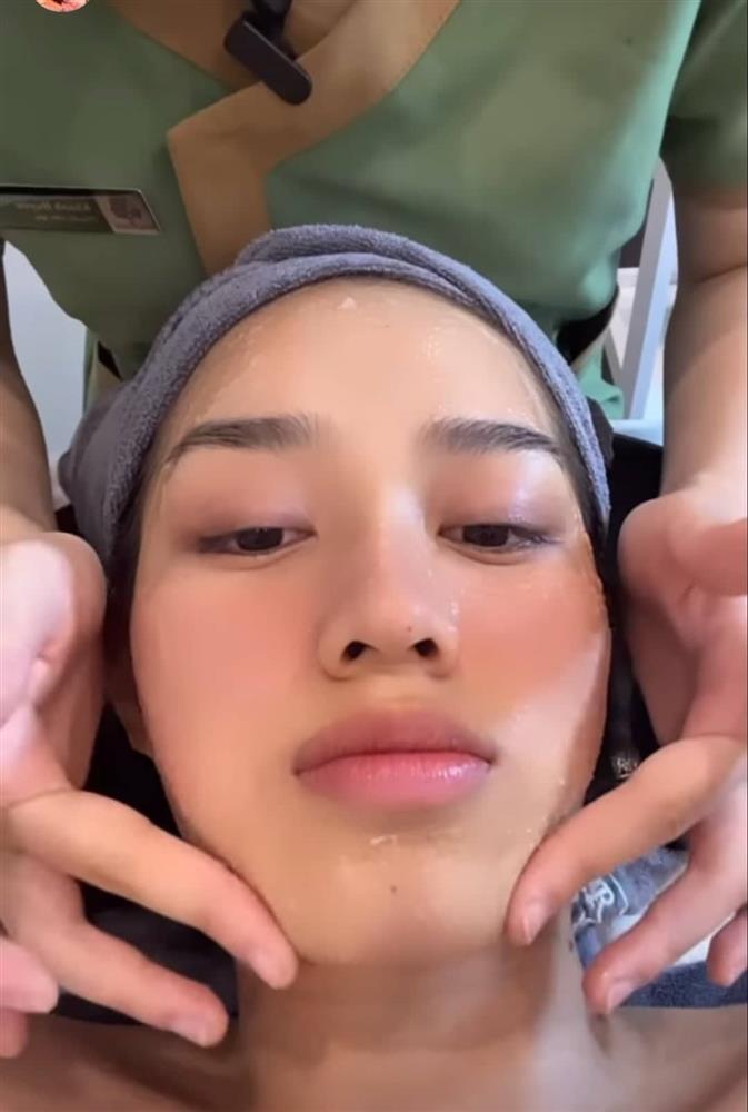 Đỗ Thị Hà băng bó khắp mặt, mới dao kéo hay gì?-5