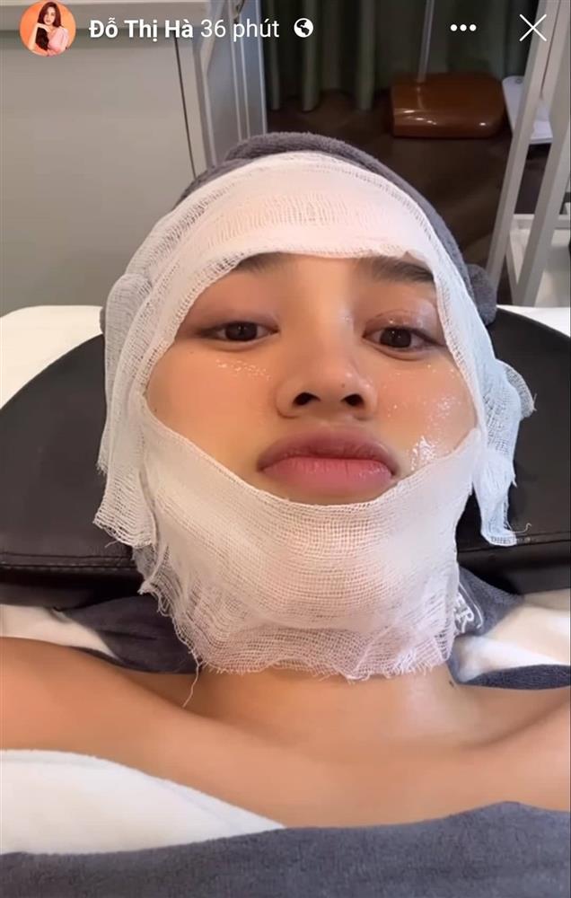 Đỗ Thị Hà băng bó khắp mặt, mới dao kéo hay gì?-6