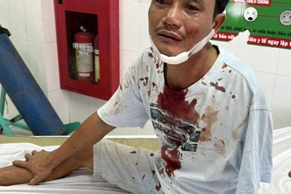 Người khuyết tật bị vợ chồng xe tải đánh đổ máu, nhập viện cấp cứu-2