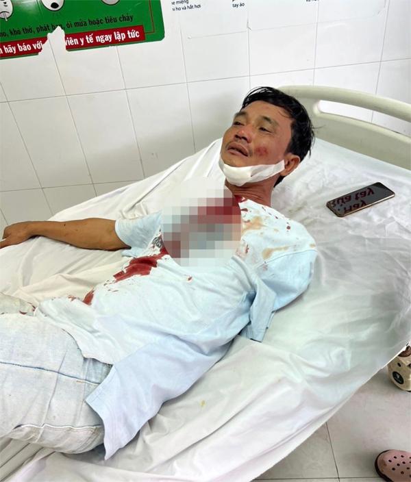 Người khuyết tật bị vợ chồng xe tải đánh đổ máu, nhập viện cấp cứu-1