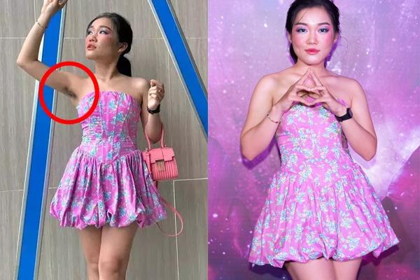 Cô gái có bộ râu rậm dài 10cm vứt bỏ dao cạo, sống hạnh phúc bên bạn trai-5