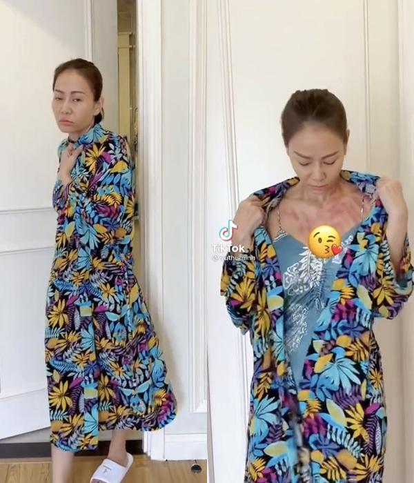 Chuyện gì đây, Thu Minh xuất hiện với cơ thể bầm dập?-1