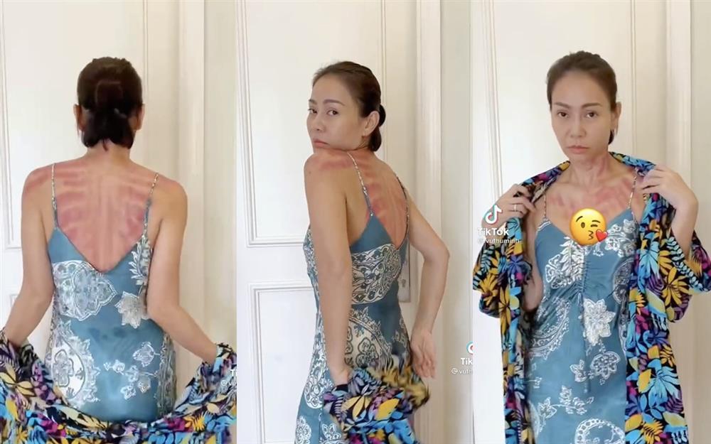 Chuyện gì đây, Thu Minh xuất hiện với cơ thể bầm dập?-2