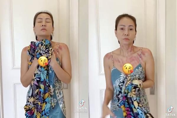 Chuyện gì đây, Thu Minh xuất hiện với cơ thể bầm dập?-3