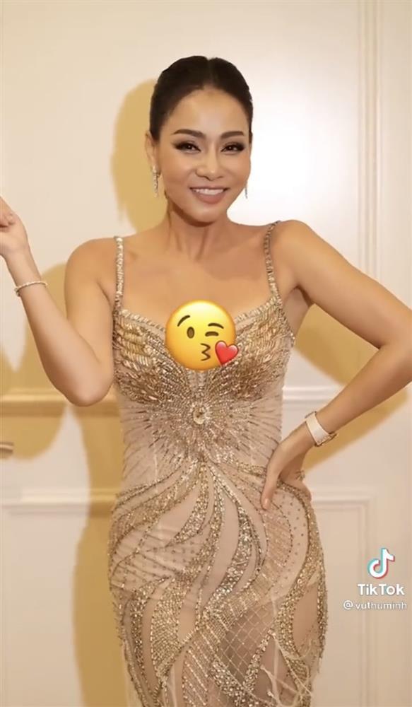 Chuyện gì đây, Thu Minh xuất hiện với cơ thể bầm dập?-5