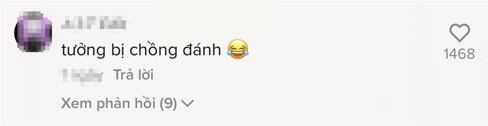 Chuyện gì đây, Thu Minh xuất hiện với cơ thể bầm dập?-6